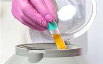 Công nghệ prp trẻ hóa