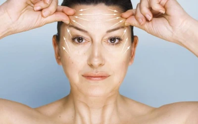 Phẫu Thuật Căng Da Trán